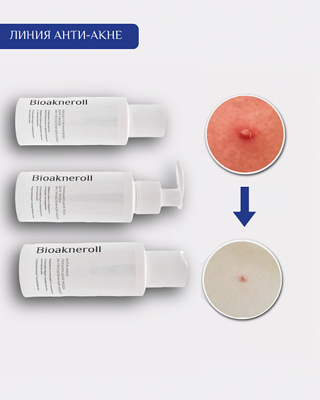 Программа "Очищение" для проблемной кожи Анти-акне Bioakneroll - вариант 3