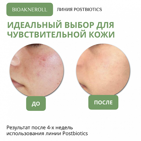 Крем для лица "Bioakneroll Postbiotics"